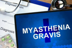 Leer alles over myasthenia gravis