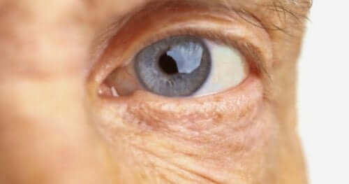 Een afbeelding van een oog