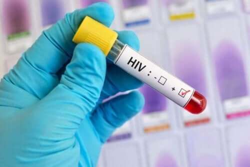 Bloedtest voor hiv