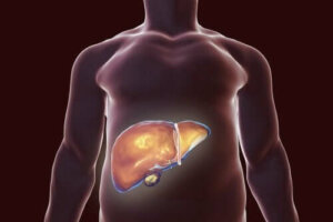 Wat wel en niet te doen bij een galblaasdieet