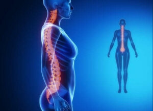 Artrose van de wervelkolom: diagnose en behandeling