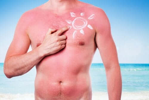 Bescherm je huid tegen de schadelijke effecten van de zon
