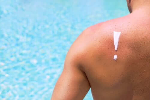 De schadelijke effecten van de zon op je huid