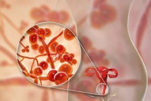 Mycoplasma genitalium: oorzaken, symptomen en behandeling