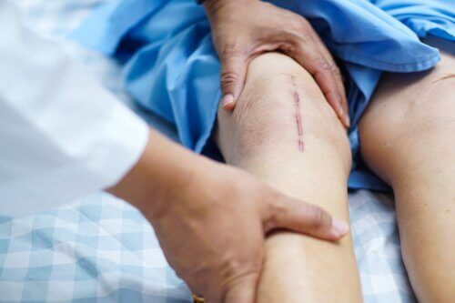 Hoe te herstellen na een knieoperatie