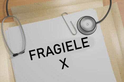 De symptomen en behandelingen van het fragiele X-syndroom