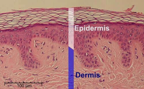 De epidermis en dermis van de huid