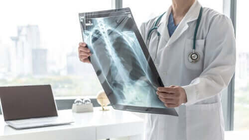 Arts bekijkt een röntgenfoto