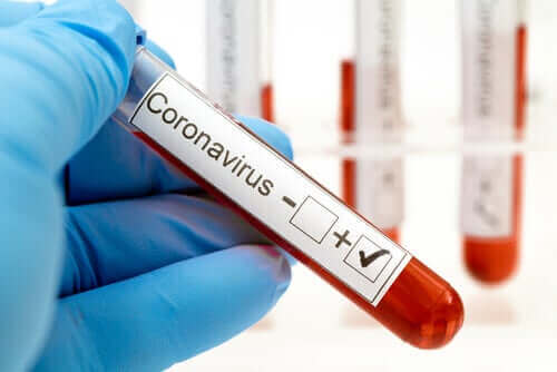 Bloedtest voor het coronavirus