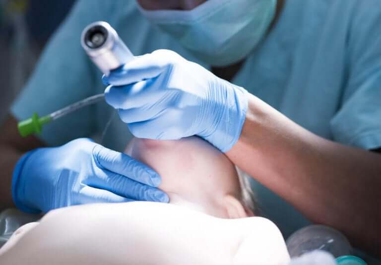 Arts voert intubatie uit