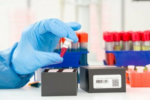 Detectie van het coronavirus: wat is een PCR-test?