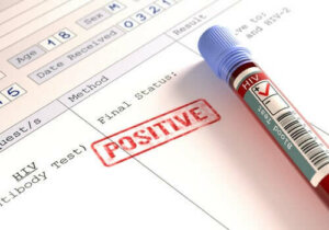 Mensen met HIV: meer risico wat betreft coronavirus?