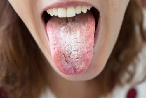 Vrouw met een witte tong