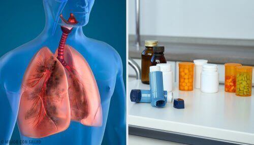 Medicijnen voor patiënten met longklachten