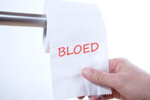 Een rectale bloeding: waarom treedt dit probleem op?