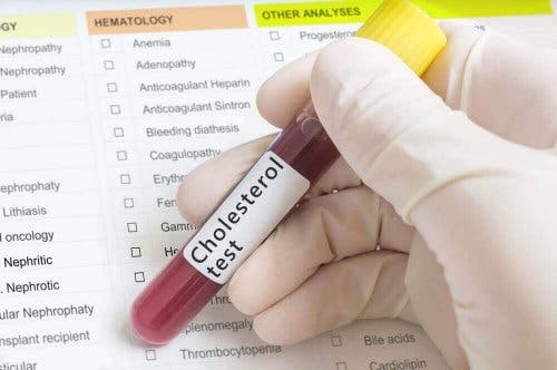 Buisje met bloed voor een cholesteroltest