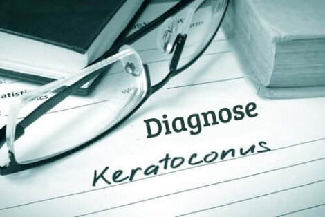 Keratoconus - kenmerken en behandeling