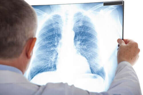 Röntgenfoto van de longen