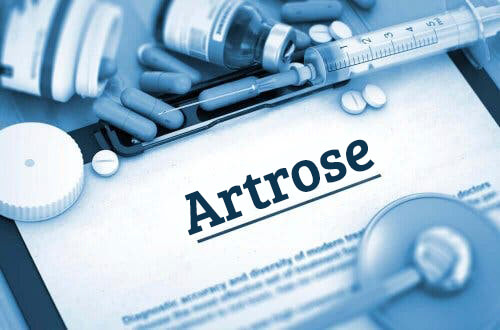 Etoricoxib gebruiken bij artrose