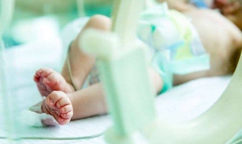 Diagnose van gastroschisis bij pasgeborenen