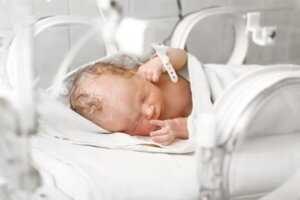 Gastroschisis bij pasgeborenen: een geboorte afwijking