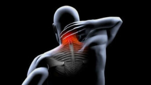 Preventie en behandeling van spiercontracturen