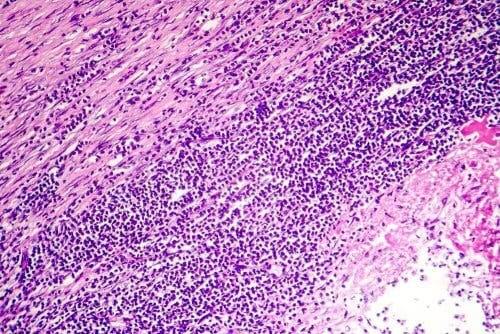 Uitvergroting van weefsel