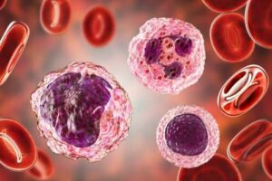 Hoge niveaus van monocyten in het bloed: symptomen en behandelingen