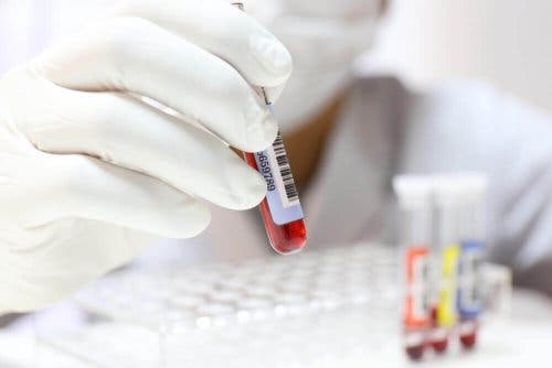 Laborant bekijkt bloedonderzoek
