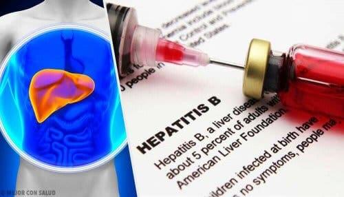 Hepatitis b en injectie
