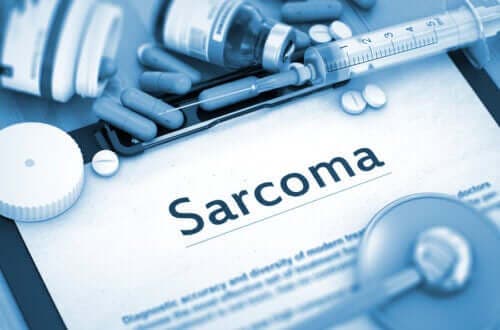Kenmerken en oorzaken van een sarcoom