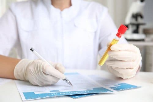 Analyse van urine