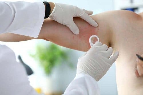 Dermatoloog checkt of patiënt rosacea heeft