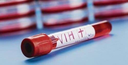 Tweede patiënt met hiv genezen