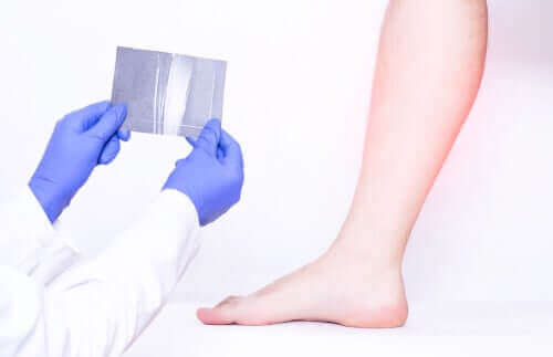 Een röntgenfoto van de kuitspieren