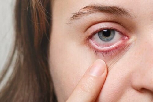 Een vrouw wijst naar haar oog