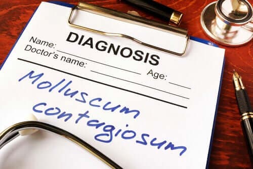 Wat is molluscum contagiosum?