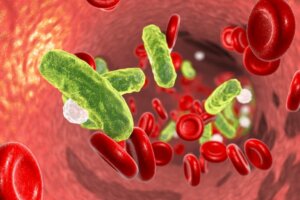 Oorzaken en behandelingen van urosepsis