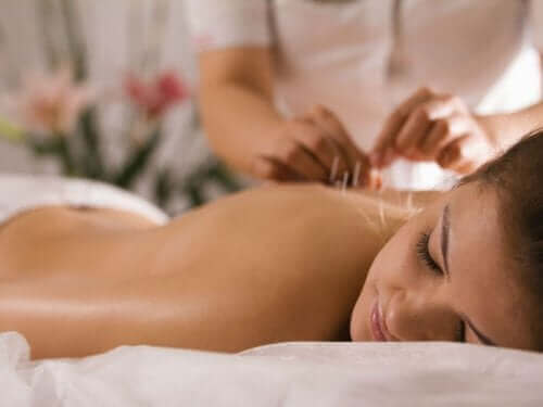 Een vrouw die acupunctuur krijgt