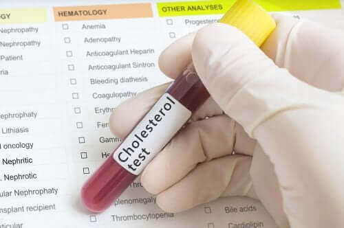Het reguleren van verhoogde cholesterolspiegels