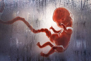De verschillende soorten abortussen die je moet kennen