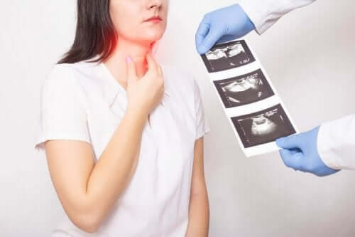 Symptomen en behandeling van schildklierkanker