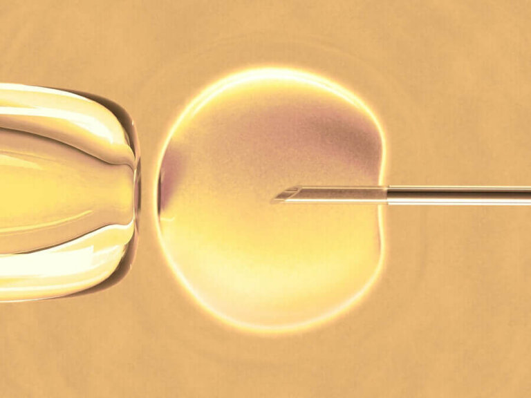 Weet jij wat in-vitrofertilisatie precies is?
