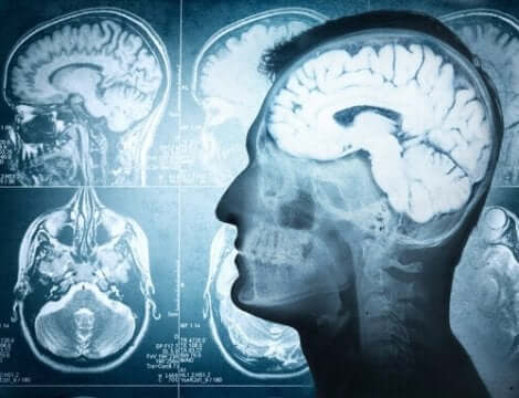beelden van hersenscans