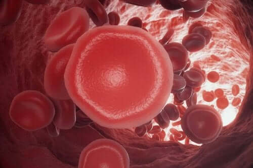 Cerebrale embolie