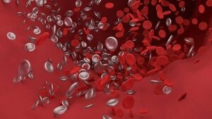 Cerebrale embolie: wat het is en hoe het ons beïnvloedt