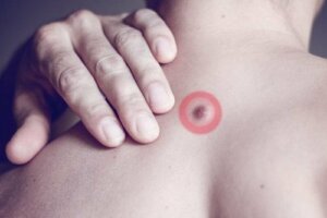 De oorzaak van vetknobbels op de rug