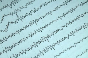 Hoe epilepsie en borstvoeding onder controle te houden