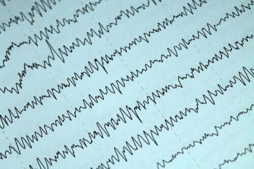 Hoe epilepsie en borstvoeding onder controle te houden