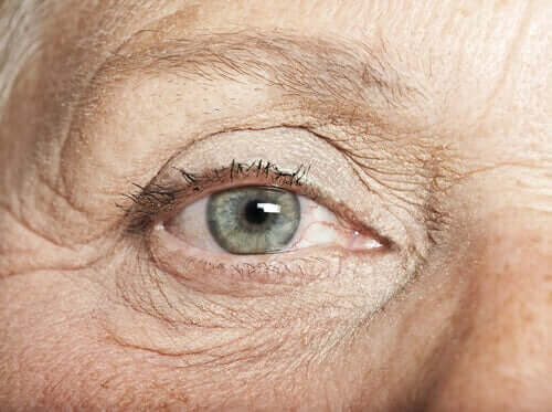Sproeten in het oog